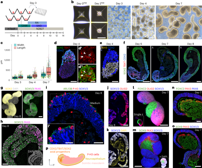 Self-organizing models of human trunk organogenesis recapitulate spinal cord and spine co-morphogenesis