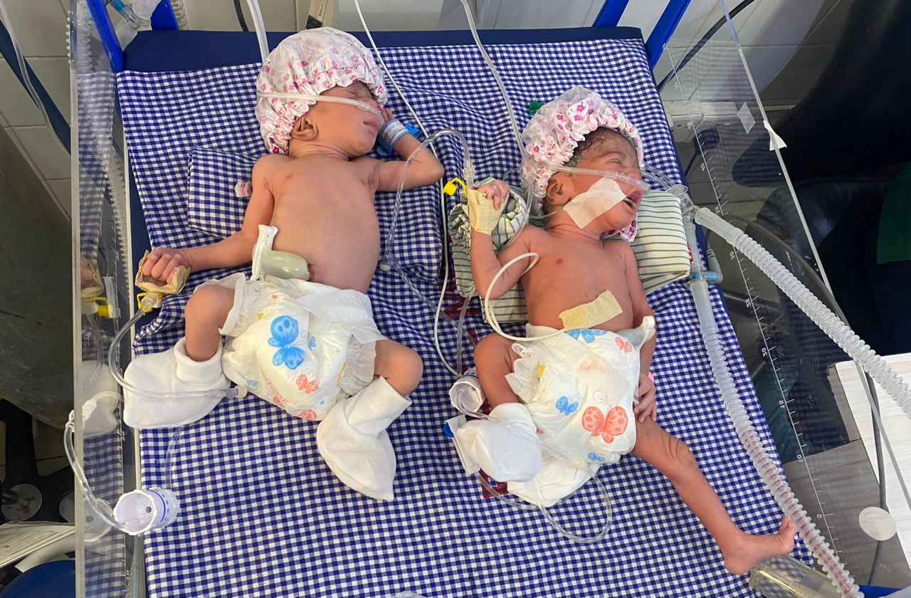 32-year-old delivers quadruplet at Eastern Regional Hospital, appeals for help