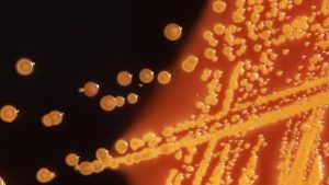 E. coli outbreak at Calgary daycare centres is over, Alberta Health Services says
