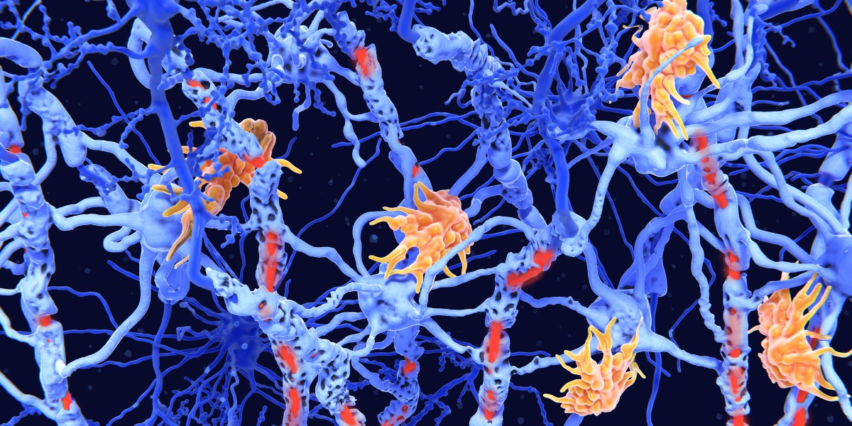 How inverse vaccines might tackle diseases like multiple sclerosis