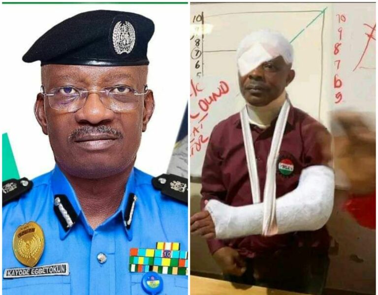 BREAKING: IGP Deploys DIG to Investigate Assault on NLC President Ajaero