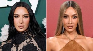 Kim Kardashian’s ‘jarred’ face fueled by a health condition?