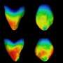 Study analyzes differences in canine teeth between European and African populations