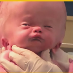 Baby was born with a HUGE HEAD, so Their Parents Decided to do The Unexpected