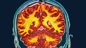 The menstrual cycle can reshape your brain