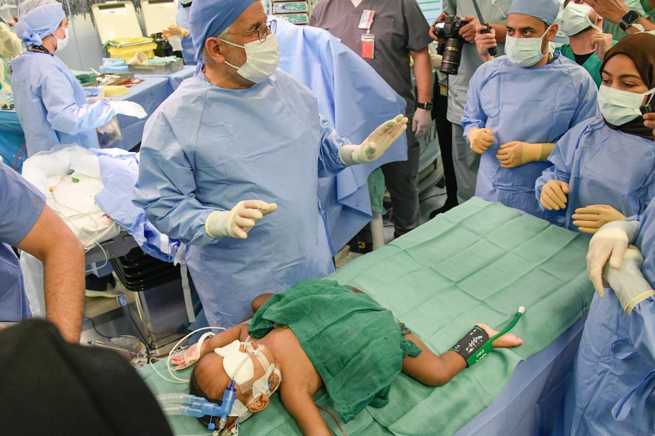 Saudi Arabian medical team separates Nigerian conjoined twins (PHOTOS)