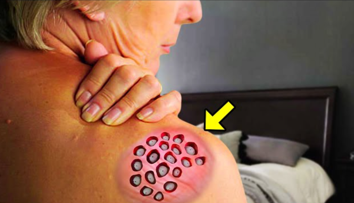 Strange Round Spots Suddenly Appeared On Her Shoulder. Doctor Sees It And Immediately Calls The Cops!