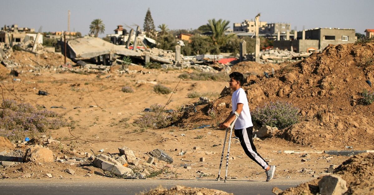 Amputations soar but prostheses and painkillers lacking in besieged Gaza