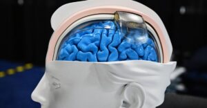 The brain tech revolution is here — and it isn’t all Black Mirror