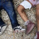 Israel’s Weaponization Of Aid In Gaza Is Leading To Preventable Suffering, Doctors Say