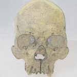 Rare form of leprosy infected people in Americas before European arrival, 4,000-year-old bones suggest
