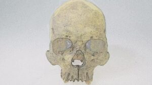 Rare form of leprosy infected people in Americas before European arrival, 4,000-year-old bones suggest