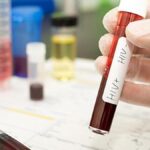 US aid cuts halt HIV vaccine research in South Africa, with global impact