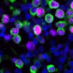 Covid-19 and flu may reawaken dormant cancer cells in the lungs