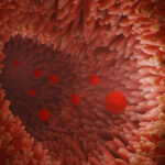 Novel Drug May Help Speed Kids’ GI Recovery in Severe Post-COVID Syndrome