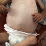 Israel Is Using Starvation To Commit Genocide In Gaza, New Amnesty Report Says