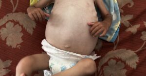 Israel Is Using Starvation To Commit Genocide In Gaza, New Amnesty Report Says