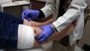This underdiagnosed vein disorder affects 4 in 10 Americans