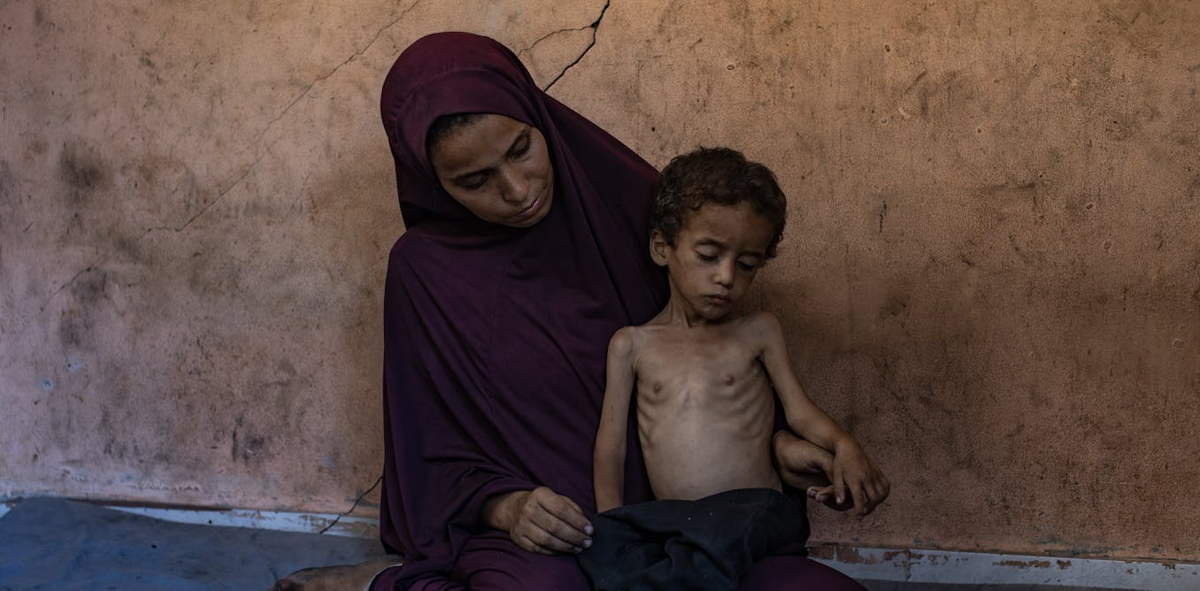 Gaza is starving – how Israel’s allies can go beyond words and take meaningful action