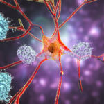 Want to Judge Data on FDA-Cleared AI Systems for Alzheimer’s? Good Luck With That