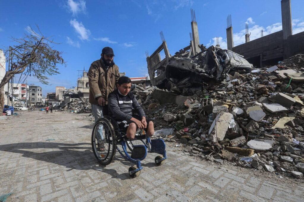 30 Palestinians Disabled Daily Amid Gaza Genocide | Mirage News