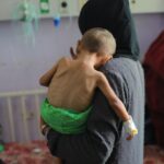I’m a Teenager In Gaza. And I Am Starving.