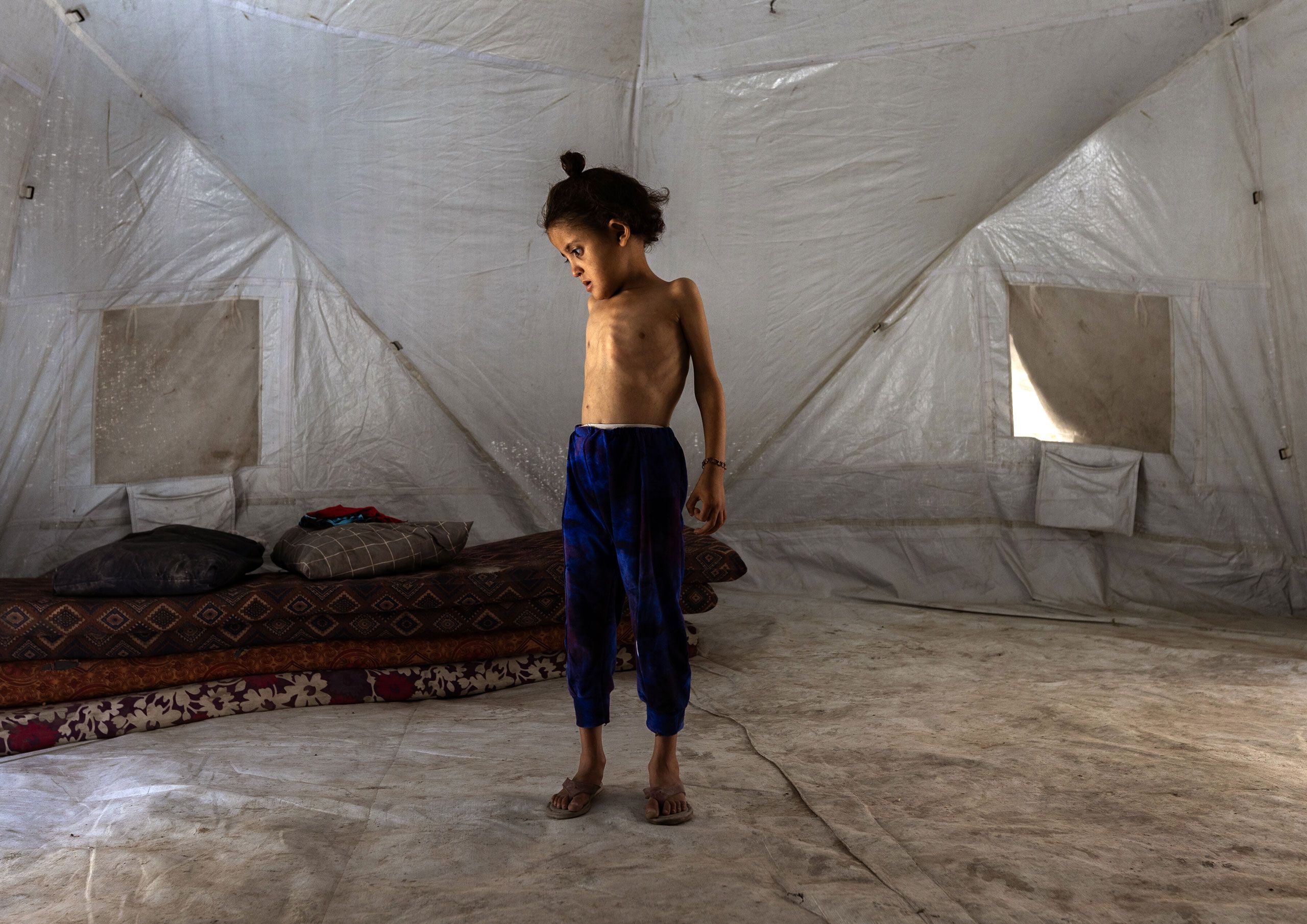 How to Prevent More Starvation Deaths in Gaza