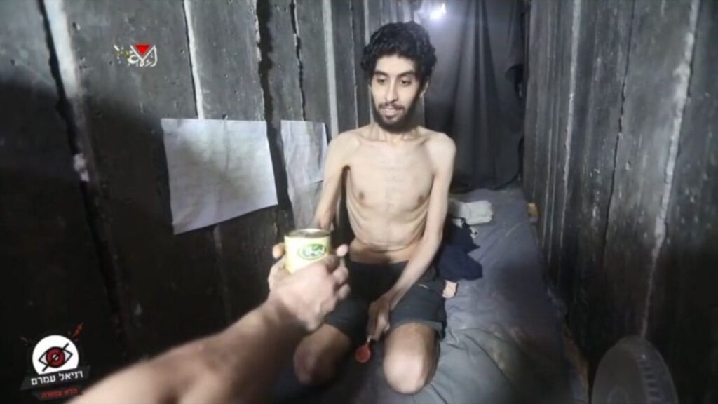 A living skeleton in Gaza: This is what hunger really looks like
