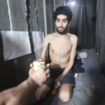 A living skeleton in Gaza: This is what hunger really looks like