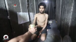 A living skeleton in Gaza: This is what hunger really looks like