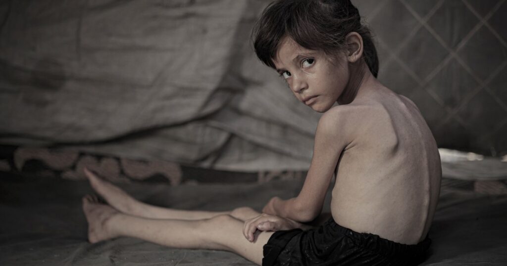 Hunger in Gaza reaches ‘tipping point’ under Israel’s offensive as children face lifelong impacts