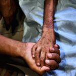 The Grave Long-Term Effects of the Gaza Malnutrition Crisis