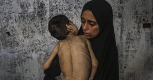 Israel Under Increased Global Pressure To End Starvation In Gaza: Live Updates