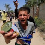 Israel slams int’l media for misrepresenting Gazan child’s condition as starvation