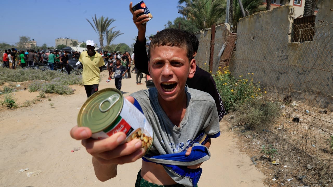 Israel slams int’l media for misrepresenting Gazan child’s condition as starvation