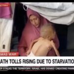 Report: Mainstream media deliberately uses images of Palestinian children with genetic diseases to push Gaza famine stories