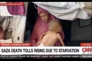 Report: Mainstream media deliberately uses images of Palestinian children with genetic diseases to push Gaza famine stories
