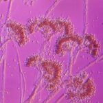 You may not really be allergic to penicillin. Here’s how to find out if you are.