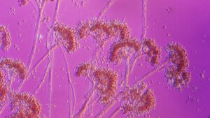 You may not really be allergic to penicillin. Here’s how to find out if you are.