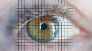 AMD Prevention: Which Strategies Help Keep Eye Disease at Bay?