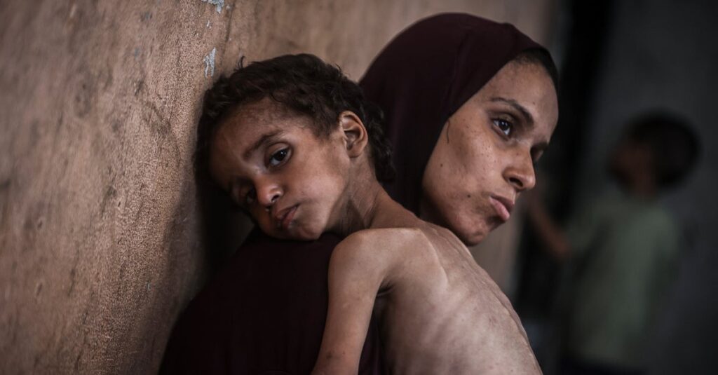Gaza Running Out Of Specialized Food To Save Malnourished Children