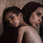 Gaza Running Out Of Specialized Food To Save Malnourished Children