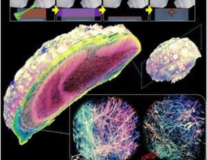 Mesoscale volumetric fluorescence imaging at nanoscale resolution by photochemical sectioning | Science