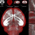 New Chinese see-through brain technique offers clearest look inside its workings