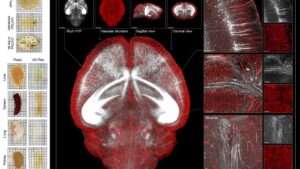 New Chinese see-through brain technique offers clearest look inside its workings