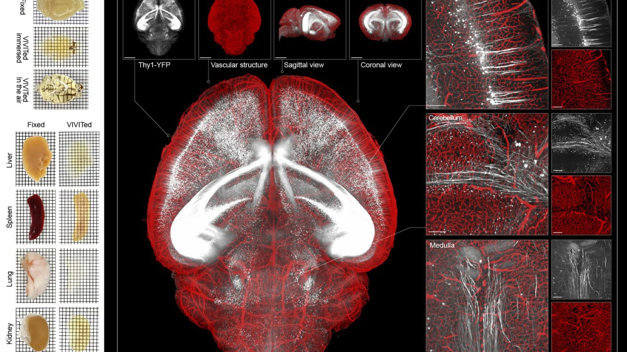 New Chinese see-through brain technique offers clearest look inside its workings