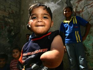 Amputees from Israel’s Gaza war use homemade prosthetics to re-enter life