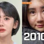 Woman Spends Over $200,000 on 400 Plastic Surgery Procedures Over 15 Years