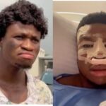 ‘I lost job opportunities because of my looks’ – Zic Saloma opens up on nose surgery