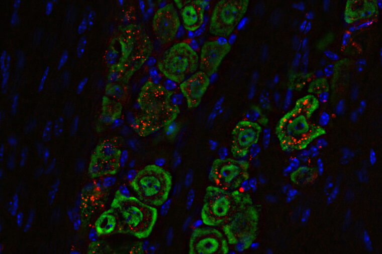 Nasal Drops Fight Brain Tumors Noninvasively | Mirage News